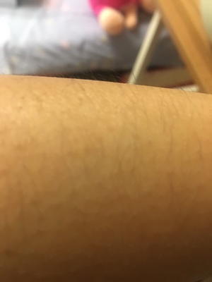 吐槽毛孩子想知道Smoothskin慕金Bare激光脱毛仪怎么样，给力吗？
