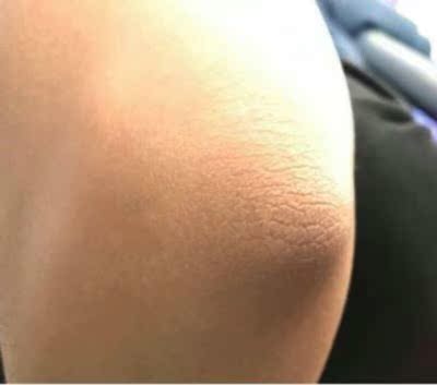 用了一段时间，才来评价的，悄悄的说一声，真的有效果，生活孩子后，黑色素上身，过了很久，都没有褪色，只能寻求产品帮忙，看了很多，选择了他们家。用过的地方，都有在渐渐地褪色，我相信坚持一直用，肯定会到预期效果