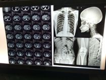 Medical Laser Blue-Based Film for OKI941 Fuji Xerox 5005 HP CT DR X-Ray