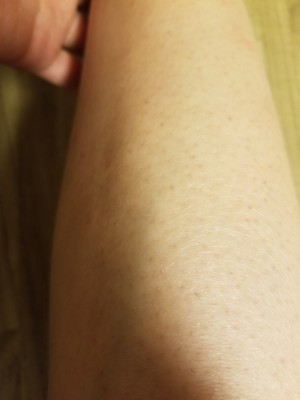 调查心得目前很火的歌岚脱毛仪怎么样,脱毛效果到底好不好?给力