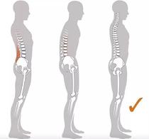 Cheng Ting's whole body posture assessment and rehabilitation treatment with chest and hunchback anterior lead pelvis and leg correction