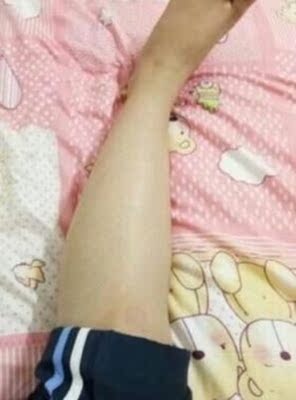 这款脱毛膏真的太好了，看朋友用别的脱毛膏脱毛贴感觉好痛流血了都，所以一直都不敢用，这次看评论都说不痛而我是那种敏感皮肤怕过敏，红痒，用过以后完全没有这个反应，可以放心使用，现在我手臂，大腿和腋下那些让人困扰的长毛全部都脱干净了，整个人都感觉清爽了很多。