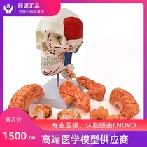 ENOVO Yinuo human skull cerebral artery anatomical structure model skull model cerebral vascular brain structure 1: