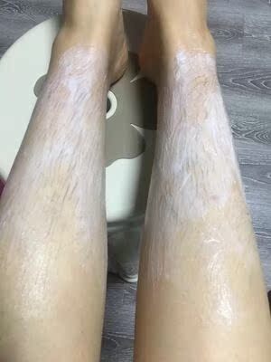 买的时候还在考虑会不会不好用，脱不下来，会不会过敏，报着试试的心态，没想到挺好用的，淡淡的香香的味道，不刺鼻，也没有过敏，没有不舒服，我先试用了腿上的一点，真的脱下来了，没有毛发的地方真干净，下次再试试腋下，会继续使用的，满意。