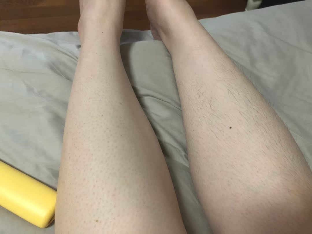 博朗AI小闪电激光脱毛仪PL3011质量合不合格，不参考后悔呀