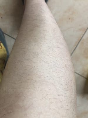 调查心得目前很火的歌岚脱毛仪怎么样,脱毛效果到底好不好?给力