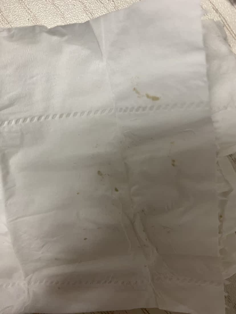用后反馈thebeautools黑头铲怎么样?使用感受好吗?
