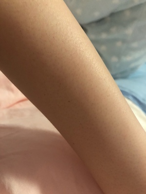 目前看来听弟妹说用慕金脱毛仪有危害吗，是否这个是误导啊？求证