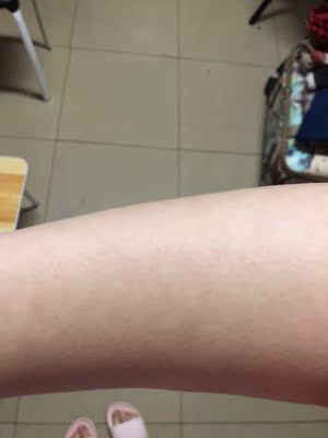 说说眼花缭乱的Ulike脱毛仪Diamond和Aurora哪款好用，该选哪一个？