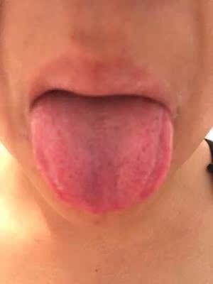 最近经常熬夜老是上火 ，不想吃药 朋友推荐说在家的茶品清火效果挺好的。试了以后。效果确实挺好的。 经常熬夜怕上火的朋友可以准备一些哟。