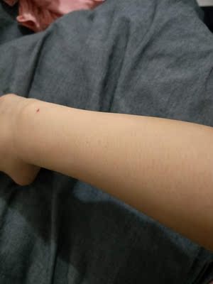 揭秘一知半解慕金脱毛仪哪款好用？用过美女来一起谈谈吧！