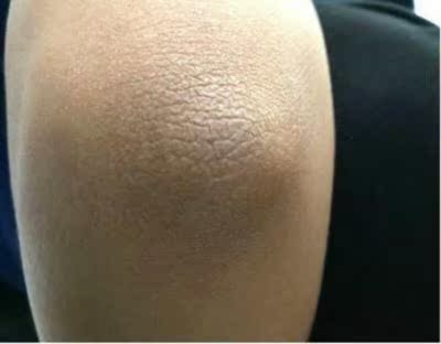 用了一段时间，才来评价的，悄悄的说一声，真的有效果，生活孩子后，黑色素上身，过了很久，都没有褪色，只能寻求产品帮忙，看了很多，选择了他们家。用过的地方，都有在渐渐地褪色，我相信坚持一直用，肯定会到预期效果