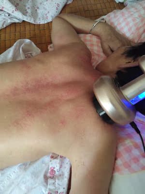 很实惠的宝贝,实用,好用,棒棒的!给妈妈做的拔罐! 很实惠的宝贝,实用,好用,棒棒的!给妈妈做的拔罐!