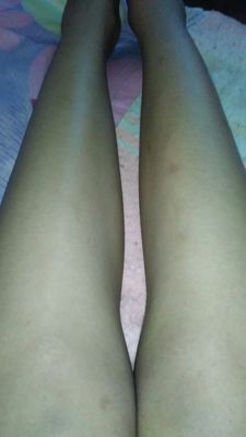 用了之后效果挺好的，刚开始刮得不干净，用纸巾擦一下就干净了。感觉皮肤变得光滑了。趁价格便宜又买了2盒。感觉不错的 ，而且客服很耐心教我怎么正确的脱毛， 好贴心的 。试用了一点 ，放在皮肤上面觉得很温和 ，闻起来也没有刺鼻的味道，过程中也挺温和的， 脱后效果明显，看起来比原来的皮肤白了好多了。