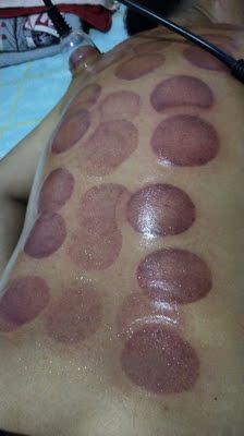 很不错,帮家人做身体,美美哒!自己用着也方便 很不错,帮家人做身体,美美哒!自己用着也方便