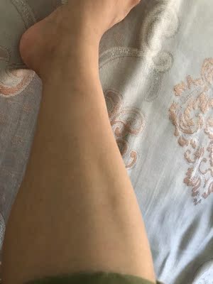 第一次用开三挡很痛，五六次过后直接开五档只有一点刺痛了，本人毛发比较多。效果真的看的见啊，以前脱毛隔天都是长很长了，现在三四天一次几乎长的很慢了，要坚持用才有效果的。出关口很考验耐心，一次都是打俩个小时。