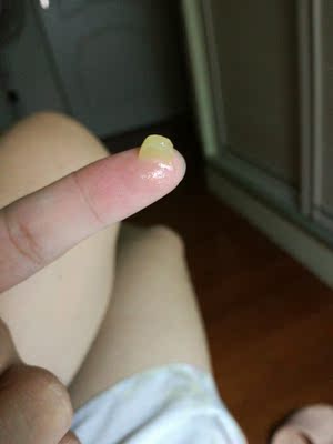 那些说&ldquo;不油&rdquo;的人真是骨骼惊奇，这样的膏体你跟我说不油？不过客观讲，挺适合做唇膜的，厚厚一层挺好。对湿疹红屁股应该也不错。不过自我感觉想用来涂蚊子包，效果有限，还是风油精之类的更好。总之，没那么神奇，各位粉友请冷静。