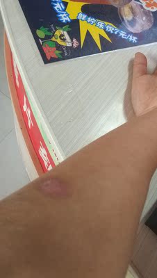 真的买来涂了被擦伤的东西，一晚上就有点长肉了，可以