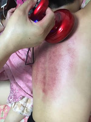 收到宝贝、到晚上就用了、力度挺大的、服务态度好、物流快、我儿子感冒刮痧一次、感觉舒服多了、身体健康的赶紧下手哦！