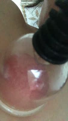 东西非常好用,做了好轻松又出好多痧 东西非常好用,做了好轻松又出好多痧