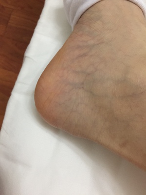 淡淡的清香，在炎热的夏天闻着也很舒服，抹了不油腻，很清爽，很滋润，我用来擦脚效果也很好👍，