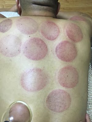 机器很好用,和美容院的效果差不多, 机器很好用,和美容院的效果差不多,