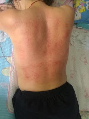 给姐姐=用了一会就出痧了，姐姐说想买一个！吸力不错，拔罐还没用