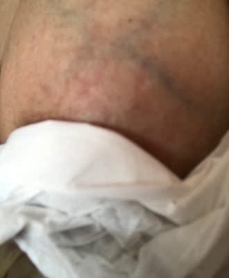 说说新安怡SCF303/01电动吸奶器怎么样,新安怡电动吸奶器质量真的很好吗?