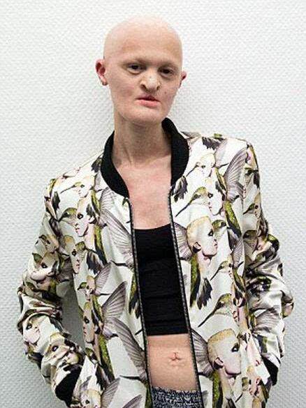 没牙齿没头发,她凭什么逆袭成为名模!