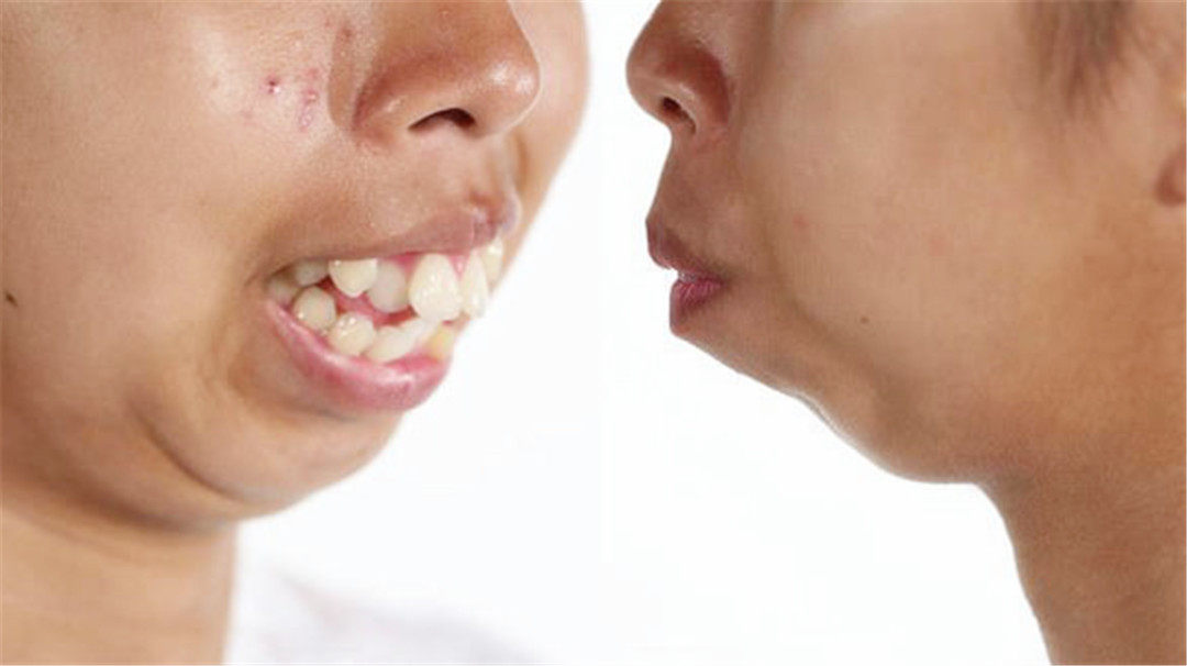 19岁少女满口龅牙,修牙后变"女神"! - 时尚日记 - 旅游网