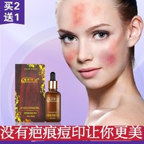 Slip cream girls children children students scratches facial surgery stitches