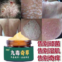Tinea capitis psoriasis folliculitis special medicine head topical scalp fungus nemesis antibacterial cream folliculitis ointment