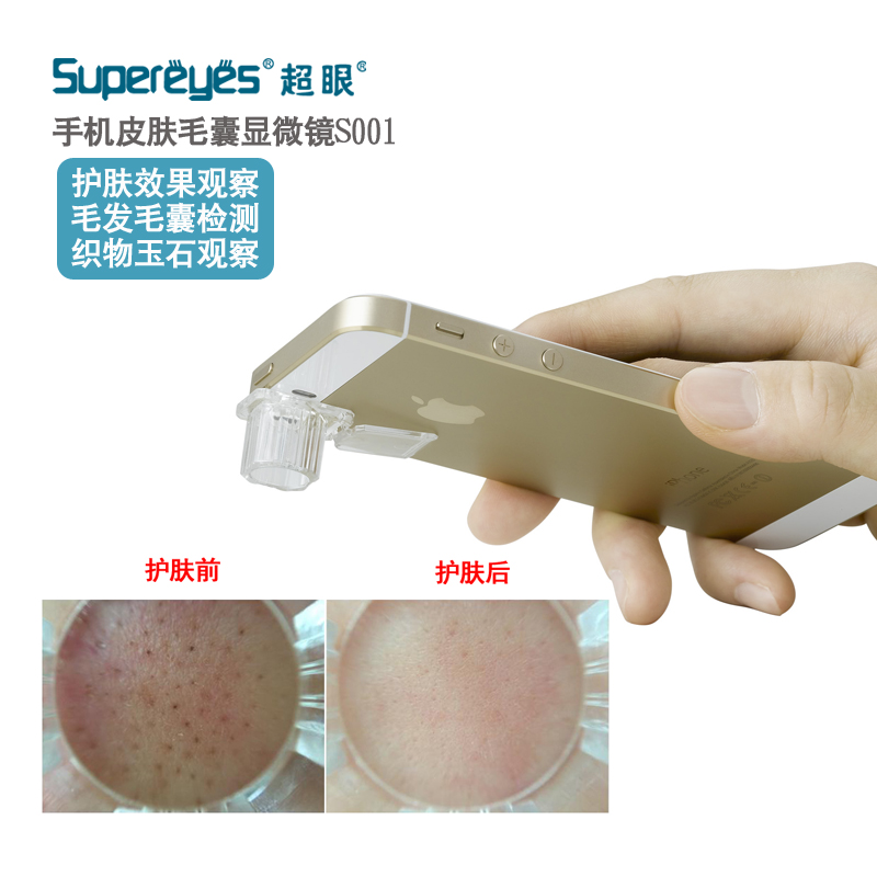 Super-eye skin Hair follicle Hair scalp Mobile phone macro magnifying glass Pore detector Blackhead microscope S001