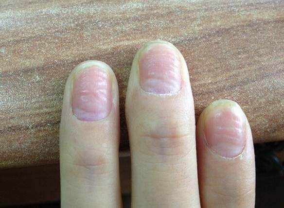 警惕来自肝脏发出的求救信号!