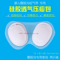 Infant hernia with special pad pack inguinal hernia treatment with hernia pack silicone pressure hernia pack single pack