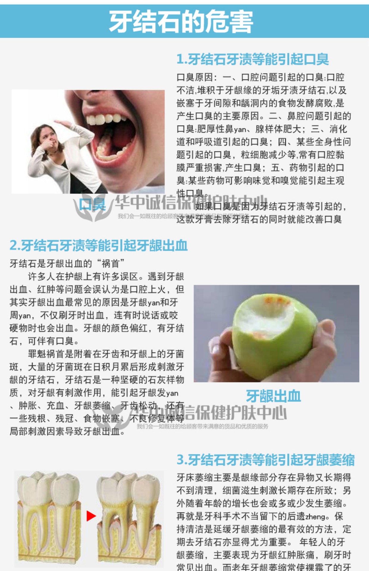 国企一口净去除牙结石牙垢牙渍牙黄牙龈萎缩口腔护理去牙结石牙膏_7折