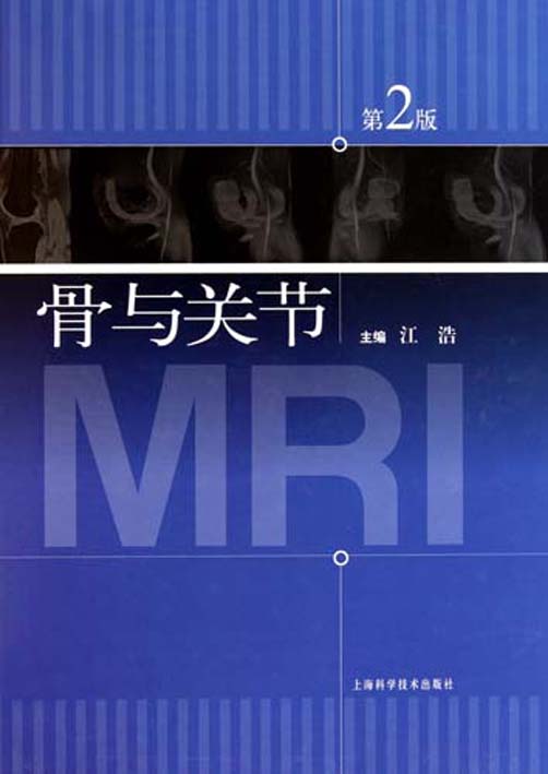 Bone and joint MRI( 2-Taobao