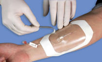 cadumedi sterilization paper frame transparent application transdermal patch swimming bath postoperative wound waterproof 10CM * 12CM