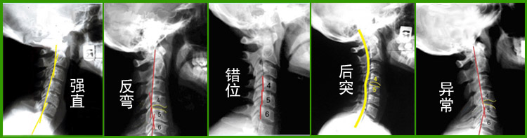 实木护颈枕成人修复颈椎专用枕头曲度按摩牵引器硬梧桐木枕头