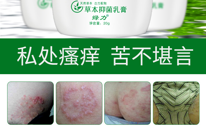 绿力康肤止痒膏肛门阴囊外阴肛周痒男女大腿内侧皮肤瘙痒股藓乳膏