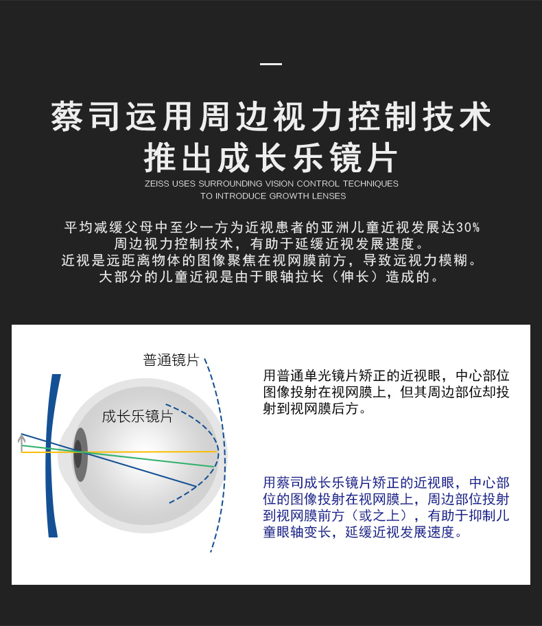 德国蔡司镜片1.50/1.60非球面成长乐莲花膜儿童近视控制眼镜片