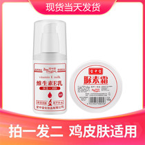 Urea cream vitamin E milk set chicken skin domestic old brand moisturizing moisturizing anti-drying urea cream