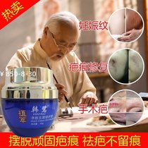 Hanlu scar cream Scar paste Facial bump scar repair hyperplasia surgery scalding light scar care acne marks