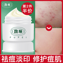 Fu Pei acne cream Acne print dilute acne artifact Student acne print Aloe vera gel official