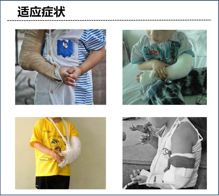 儿童型手臂肘部固定支具上肢骨折固定支具肘关节固定骨折吊带夹板