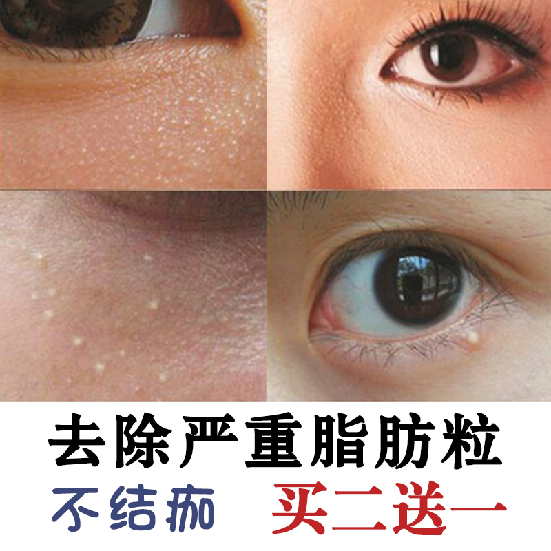 瑞士美华丽眼者哩怎么样_心美眼美孔加盟_瑞士美华丽眼者哩