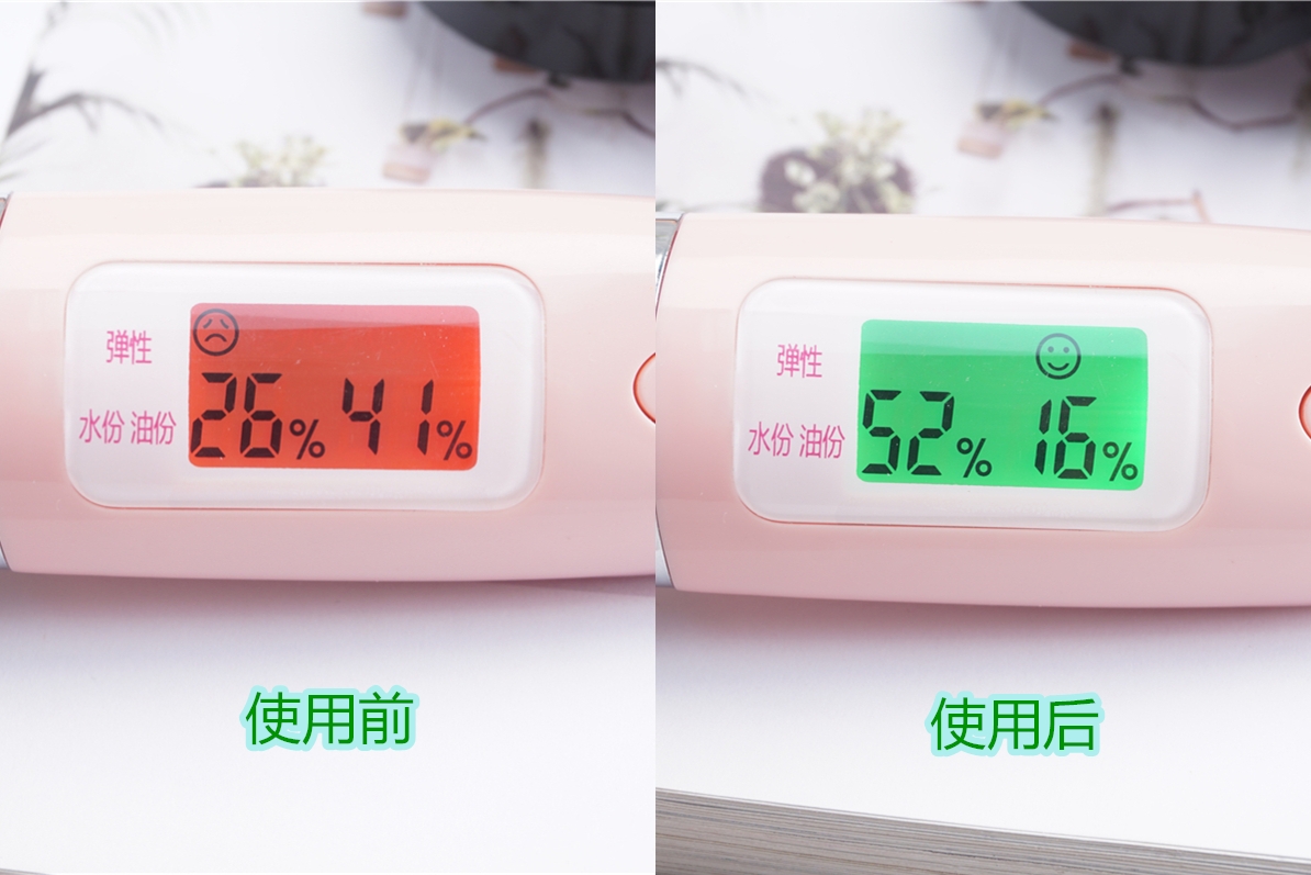 油痘肌亲妈!VT白金老虎气垫养肤上妆