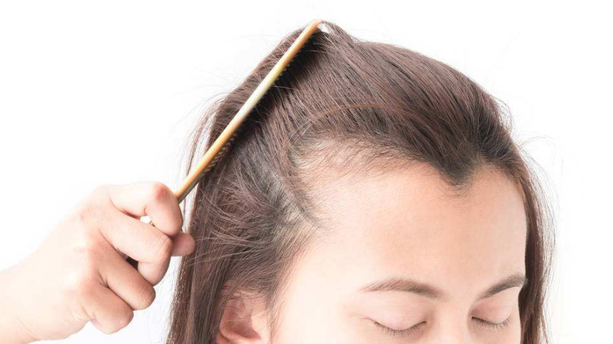 如何拯救过高的发际线?第三条一定要学会
