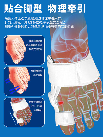독일 브랜드 썸 valgus 교정기 큰 발 뼈 발가락 굽힘 정형 외과 발가락 스플리터 수정 벨트 도구 독일 브랜드 썸 valgus 교정기 큰 발 뼈 발가락 굽힘 정형 외과 발가락 스플리터 수정 벨트 도구
