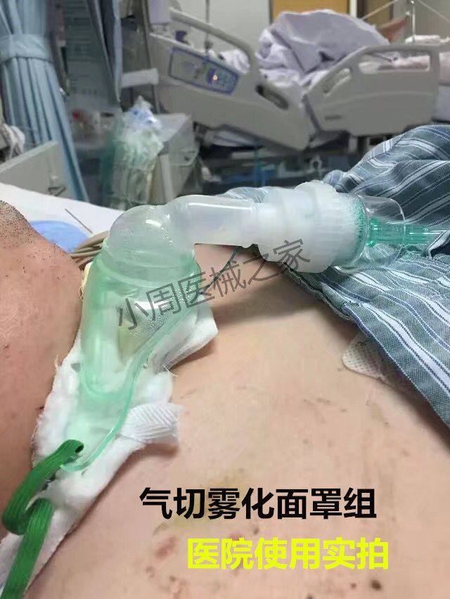 进口气管切开病人的湿化秘籍:雾化面罩/气切喷雾瓶组喉部面罩全解析